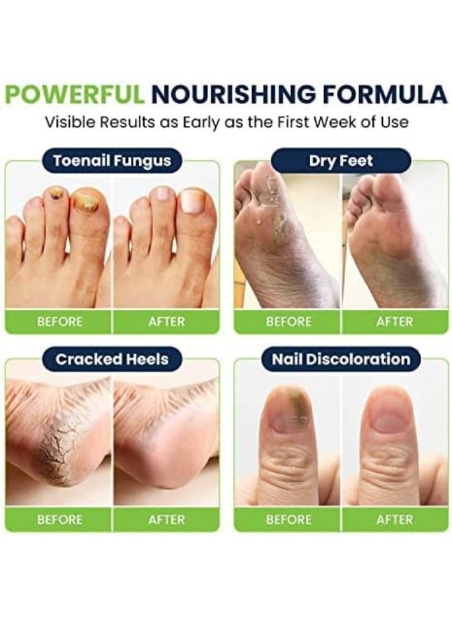 FOOT CURE Toenail Fungus Treatment Kit Extra Strength - Soak, Repair Pen & Tea Tree Balm - Image 5